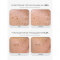 MEDICUBE, Укрепляющая сыворотка с ПДРН и пептидами, 30 мл, PDRN Pink Peptide Serum MEDICUBE, Укрепляющая сыворотка с ПДРН и пептидами, 30 мл, PDRN Pink Peptide Serum