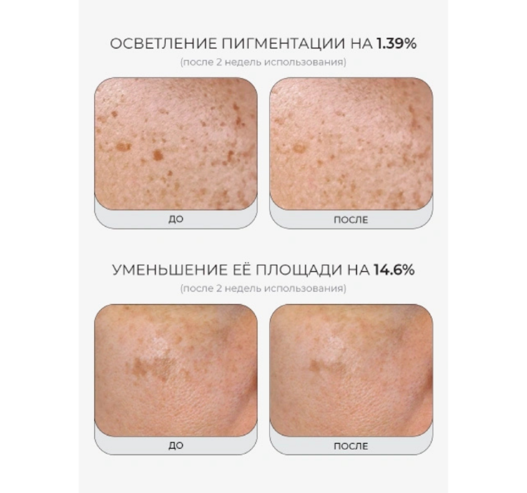 MEDICUBE, Укрепляющая сыворотка с ПДРН и пептидами, 30 мл, PDRN Pink Peptide Serum