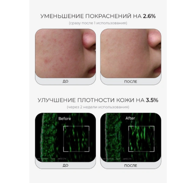 MEDICUBE, Укрепляющая сыворотка с ПДРН и пептидами, 30 мл, PDRN Pink Peptide Serum