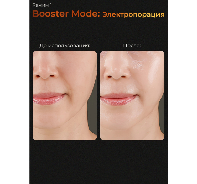 MEDICUBE Микротоковый аппарат для лица 6-в-1 AGE-R Booster Pro Black