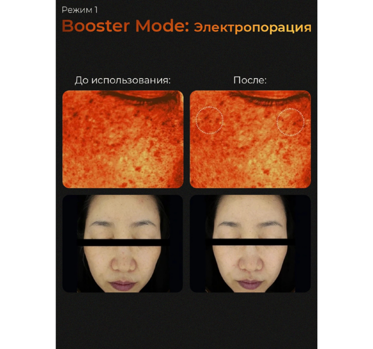 MEDICUBE Микротоковый аппарат для лица 6-в-1 AGE-R Booster Pro Black