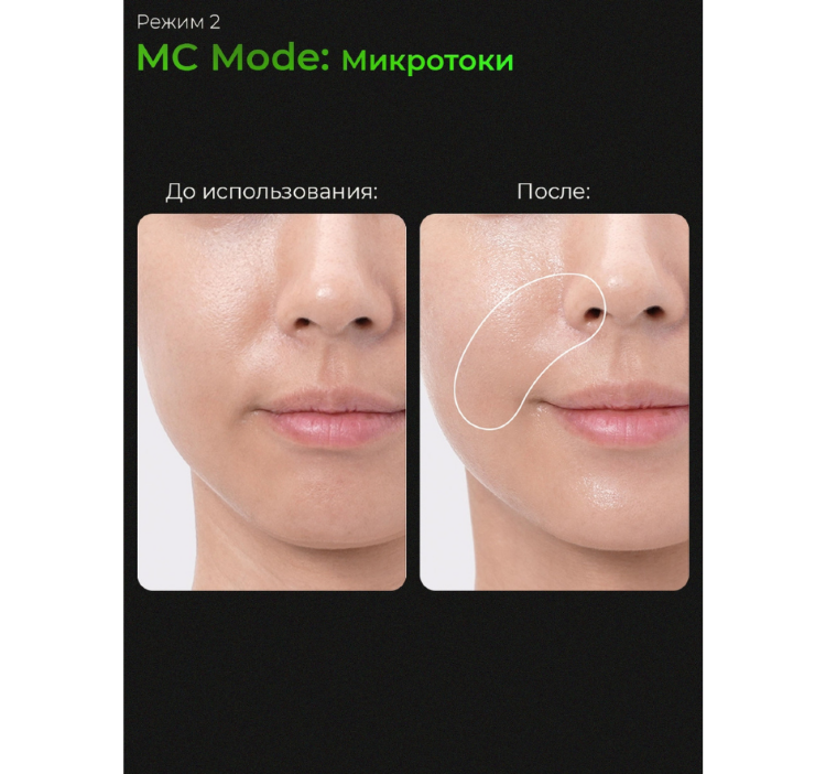 MEDICUBE Микротоковый аппарат для лица 6-в-1 AGE-R Booster Pro Black