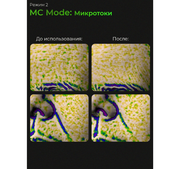 MEDICUBE Микротоковый аппарат для лица 6-в-1 AGE-R Booster Pro Black