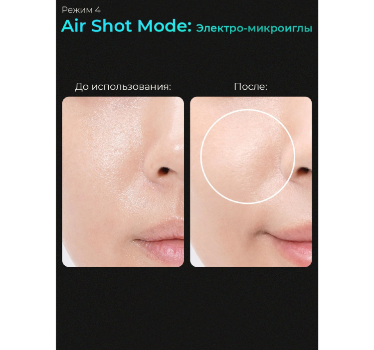 MEDICUBE Микротоковый аппарат для лица 6-в-1 AGE-R Booster Pro Black