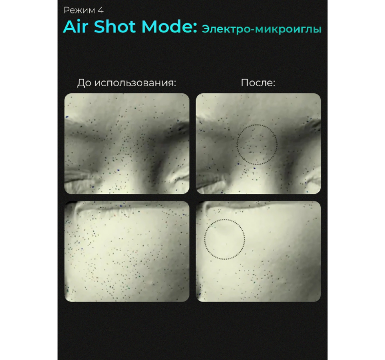 MEDICUBE Микротоковый аппарат для лица 6-в-1 AGE-R Booster Pro Black