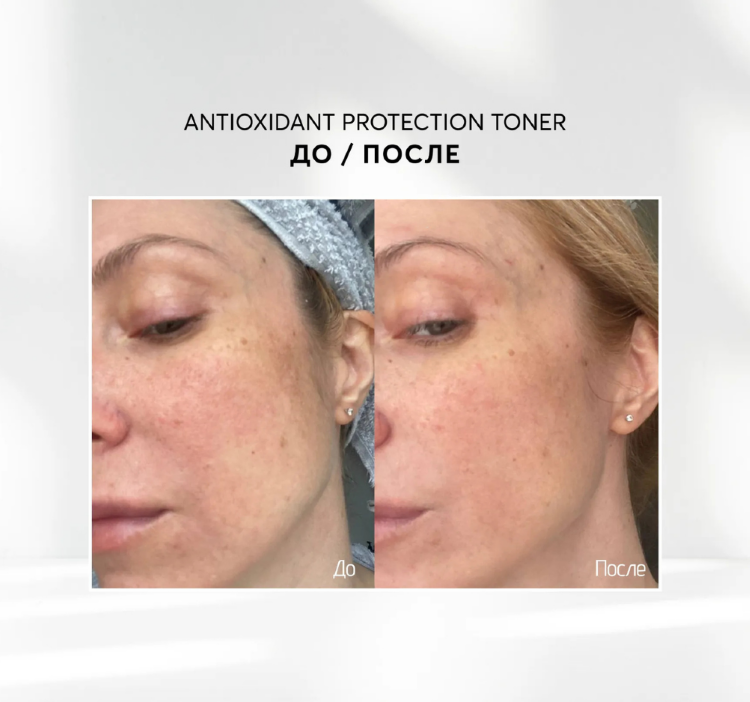 SKINJESTIQUE, Антивозрастной тонер с пептидами, 100 мл, Skinjestique Intensive Anti-Aging Multi-Pept