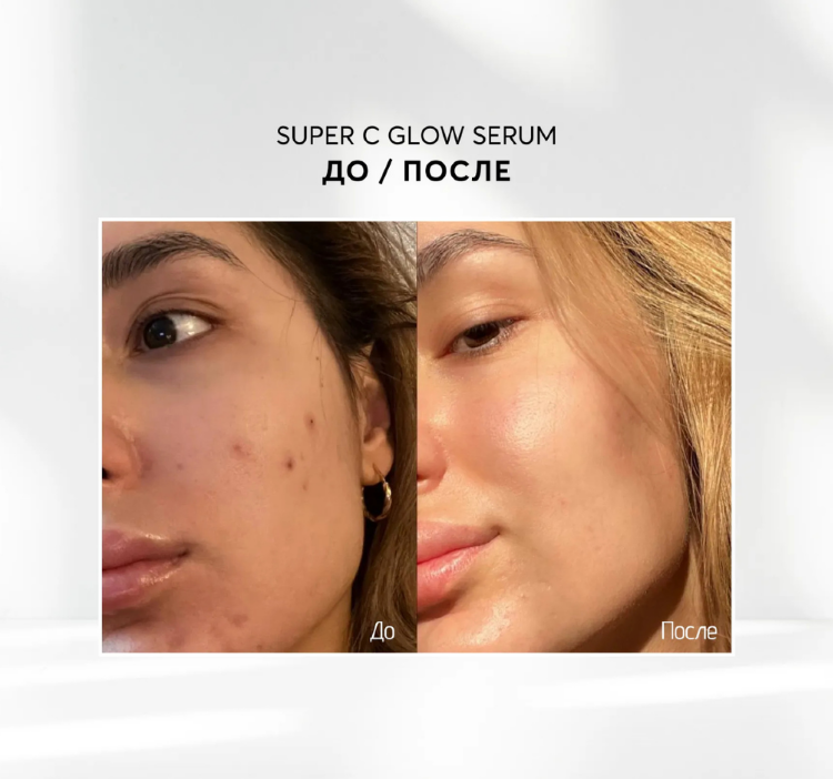 SKINJESTIQUE,Сыворотка для сияния кожи с витамином, 30 мл, C Super C Glow Serum