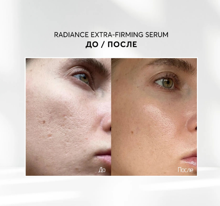 SKINJESTIQUE, Лифтинг сыворотка для выравнивания и сияния кожи, 30 мл, Radiance Extra-Firming Serum