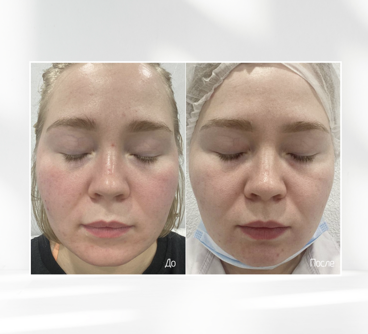 SKINJESTIQUE, Успокаивающий крем для лица, 50мл, Skin Redness Balance Cream