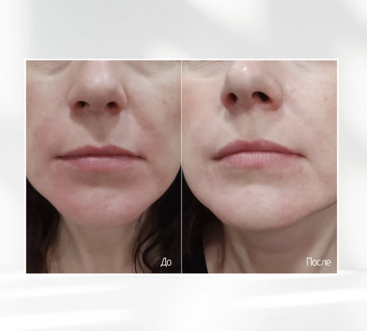 SKINJESTIQUE, Успокаивающий крем для лица, 50мл, Skin Redness Balance Cream
