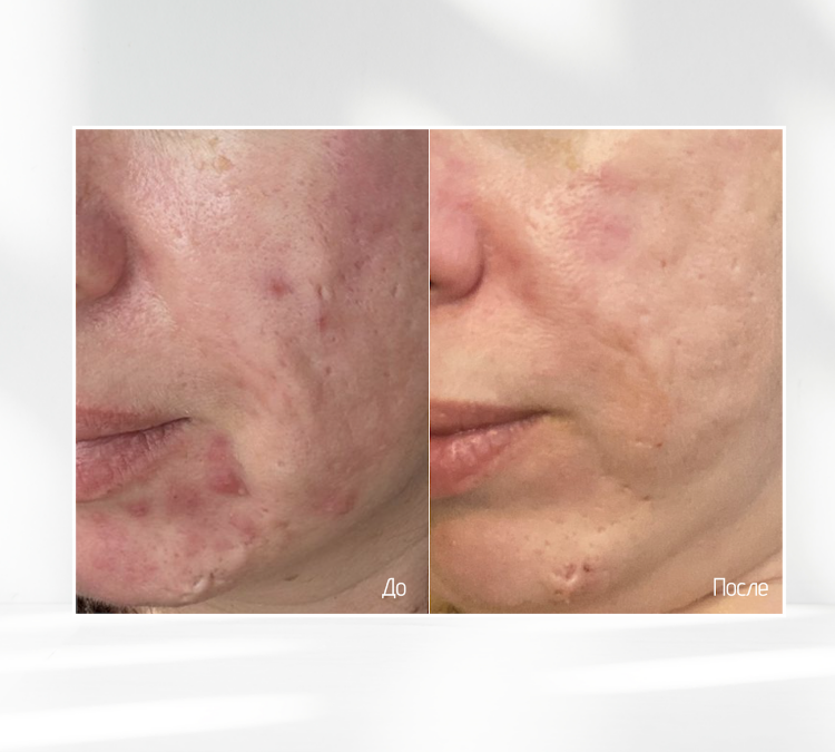 SKINJESTIQUE, Успокаивающий крем для лица, 50мл, Skin Redness Balance Cream