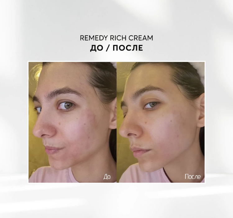 SKINJESTIQUE, Успокаивающий питательный крем, 50мл, Remedy Rich Cream