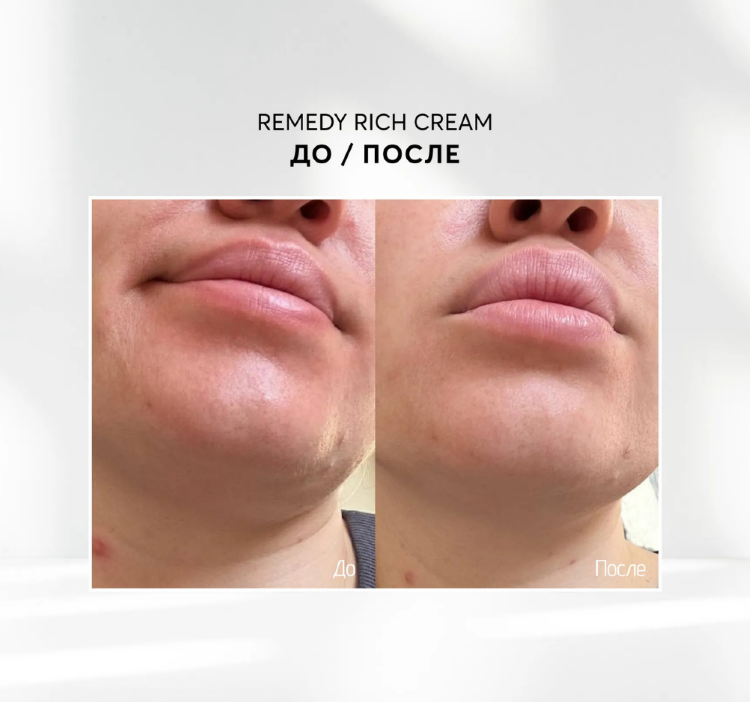 SKINJESTIQUE, Успокаивающий питательный крем, 50мл, Remedy Rich Cream