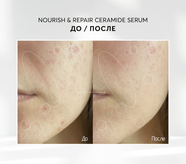 SKINJESTIQUE, Восстанавливающая сыворотка с керамидами, 30 мл, Nourish & Repair Ceramide Serum