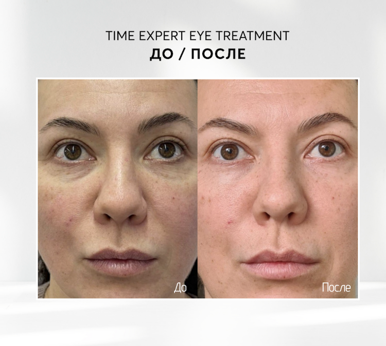SKINJESTIQUE, Крем для век с кофеином от морщин и отеков, 15мл, Time Expert Eye Treatment