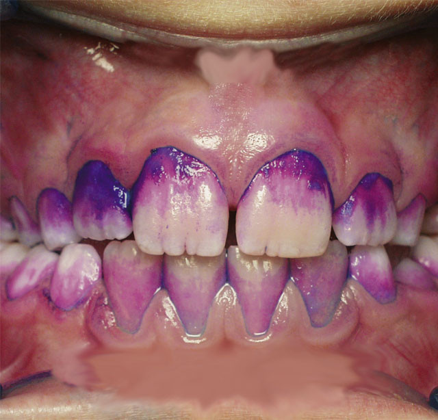 CURAPROX Таблетки для индикации зубного налета (12 шт)