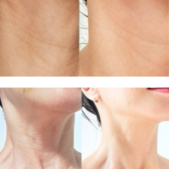MEDI-PEEL,PREMIUM 3.0 COLLAGEN NAITE THREAD NECK CREM Моделирующий крем для шеи и декольте , 100 мл